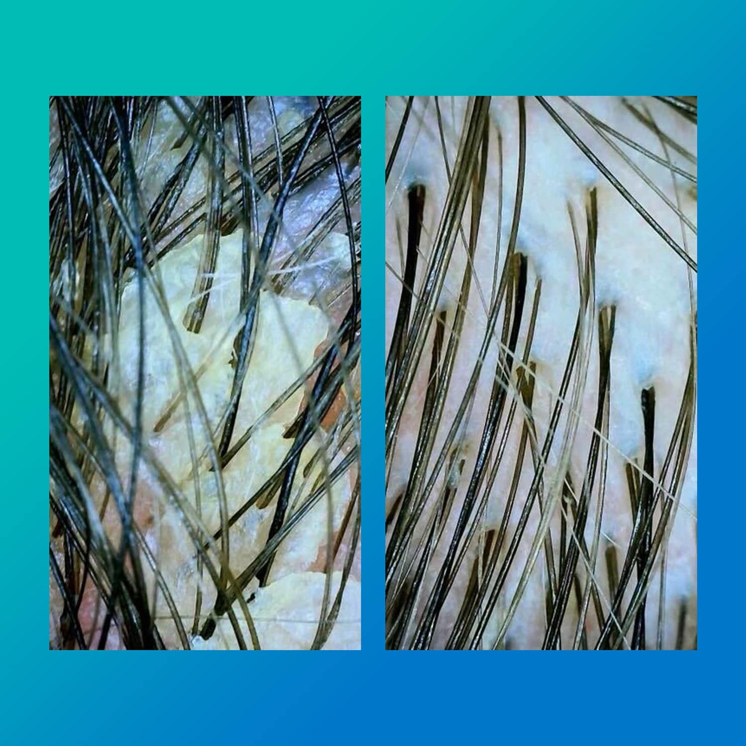 SHAMPOO DETOX - K18